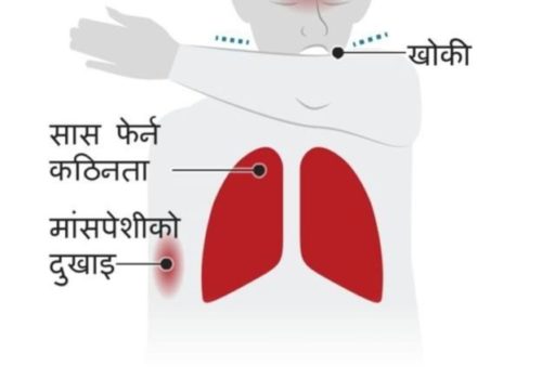 कोरोनाले विश्वभर ६४ हजारको मृत्यु, १२ लाख संक्रमित